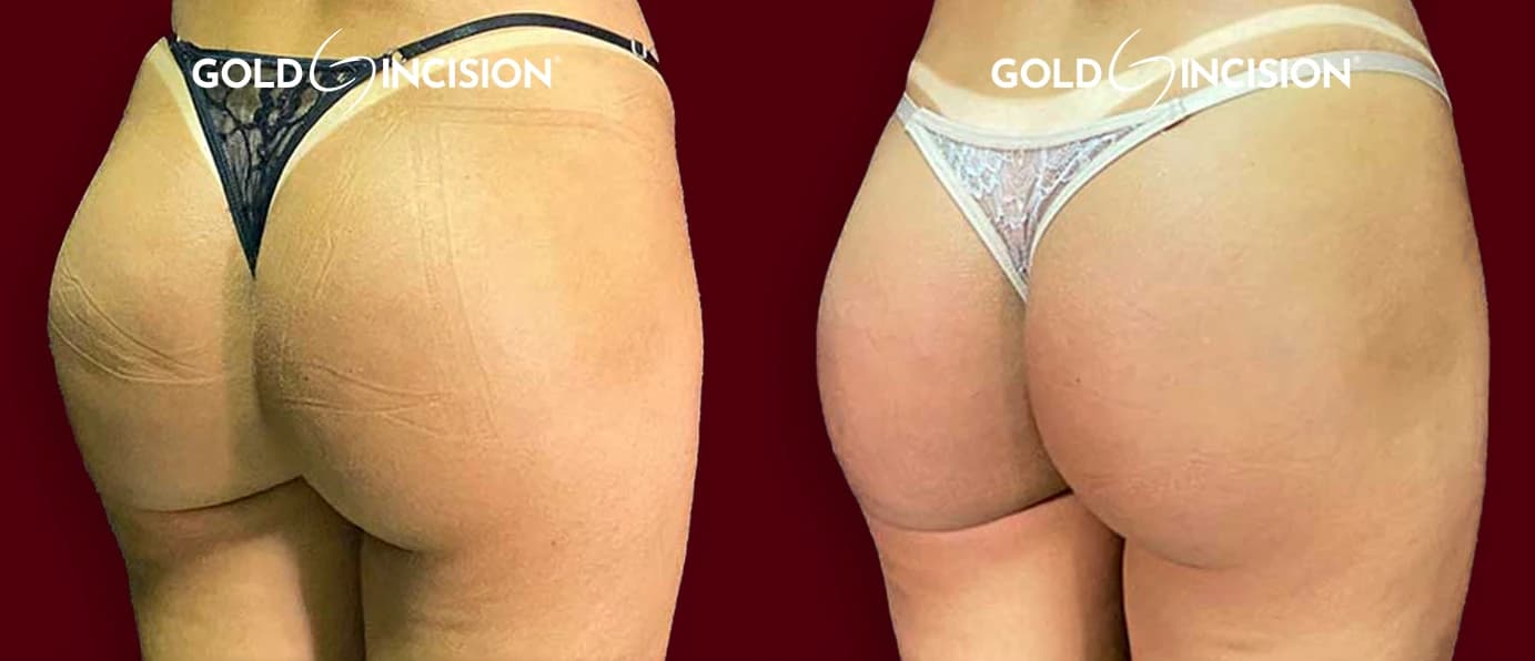 Antes e depois da avaliação do tratamento