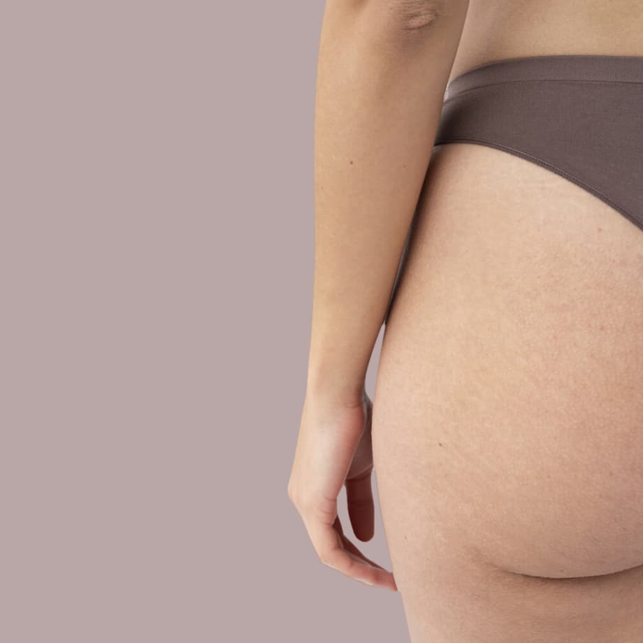 Tratamento NoWave® para celulite